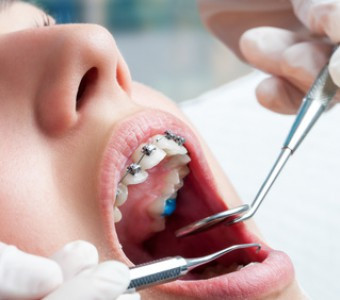 Decálogo del tratamiento de Ortodoncia. 