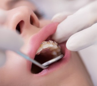 Tratamiento de Ortodoncia en pacientes con diabetes